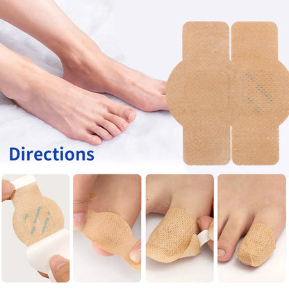 Nail Care Patches for Fungus-Prone & Ingrown Toenails