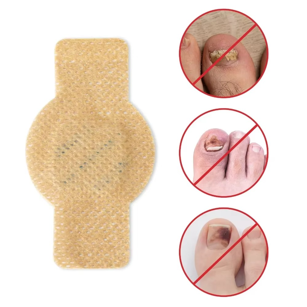 Nail Care Patches for Fungus-Prone & Ingrown Toenails