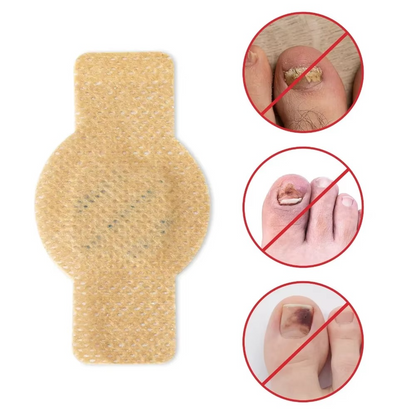 Nail Care Patches for Fungus-Prone & Ingrown Toenails